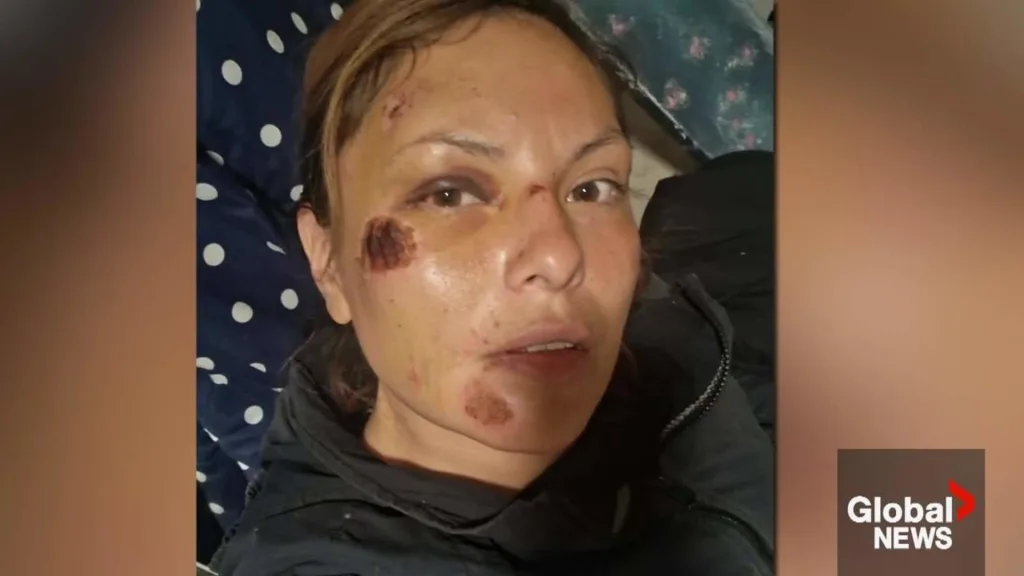 Calgary Residents Concerned Over Allegations of Police Misconduct